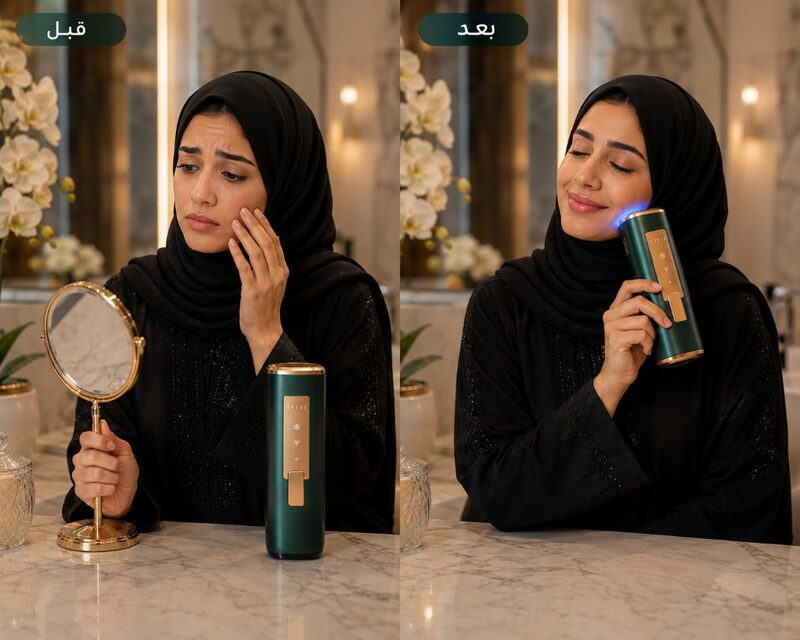 قبل وبعد — نتائج الوجه